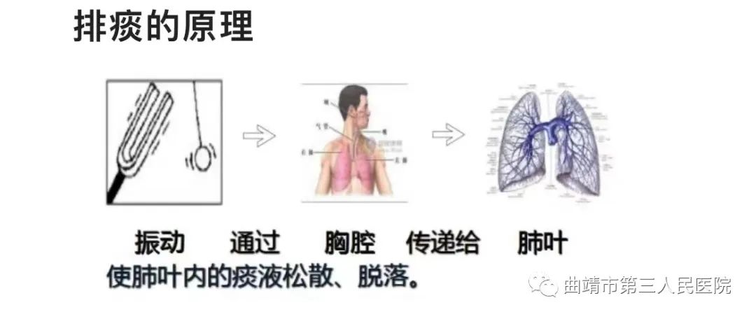 如何利用机械辅助排痰