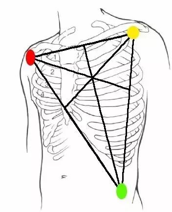 心电监测仪怎么看心电监护仪的操作注意事项_https://www.jmylbn.com_新闻资讯_第3张