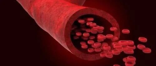 疏通血管，心血管领域最大的谎言！不添堵才是关键！