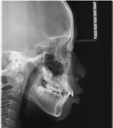 口腔ct怎么看看牙为什么要进行口腔CT检查？不想花这笔钱？_https://www.jmylbn.com_新闻资讯_第6张