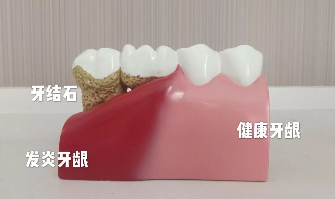 五一劳动节 | 让口腔健康动起来！
