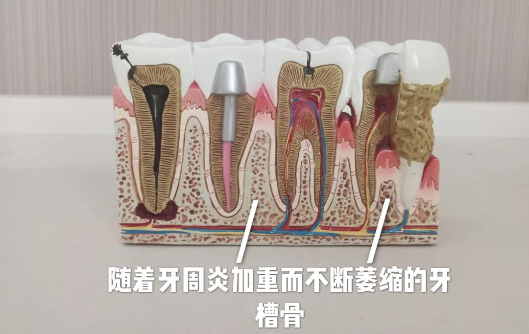 五一劳动节 | 让口腔健康动起来！