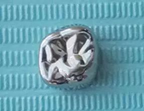 儿童乳牙预成冠详细讲解