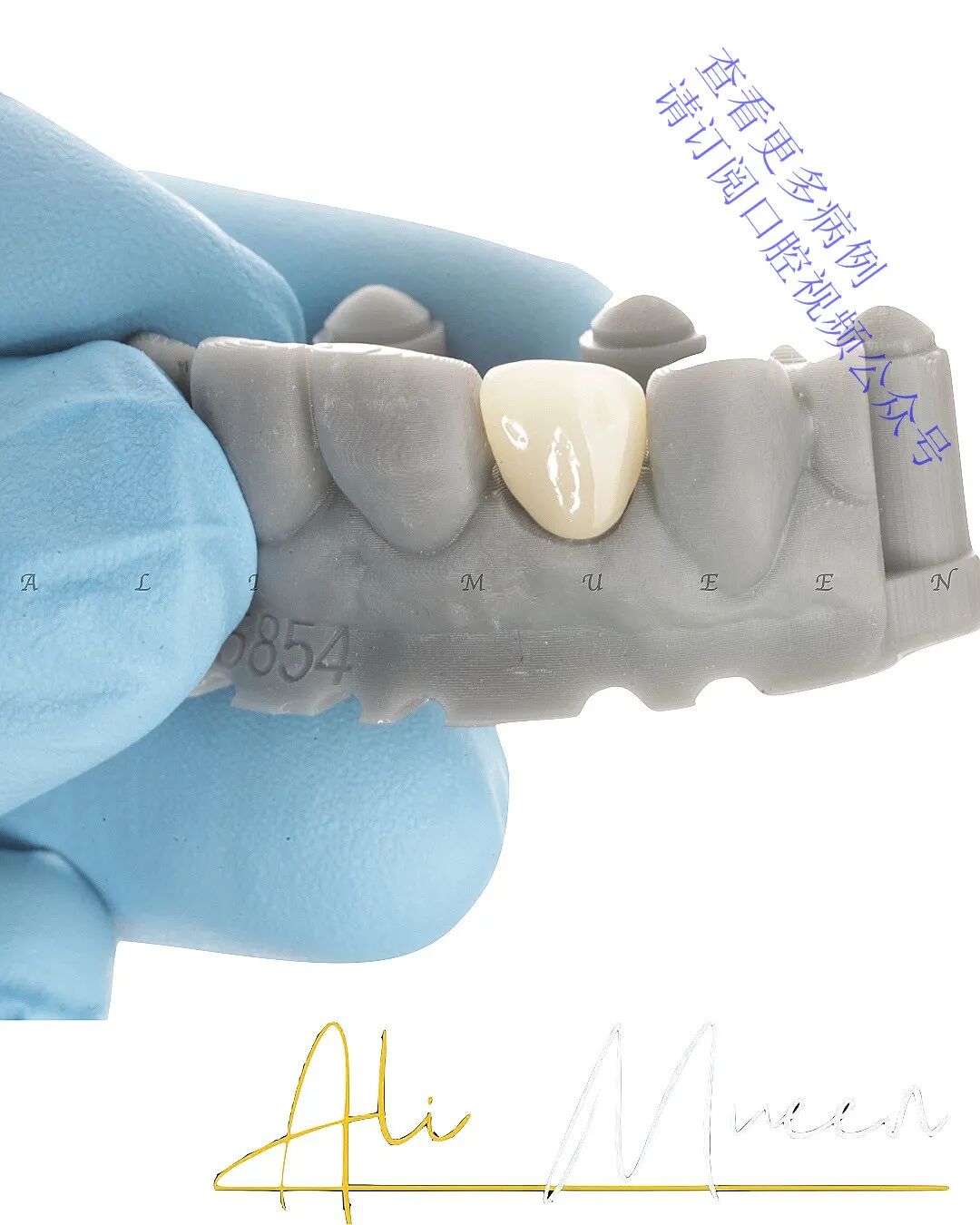 看一个利用箍效应的修复