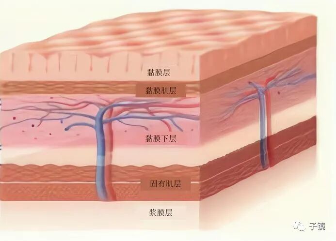 平时血管切断怎么止血ESD核心技术之“防出血和快速止血”学习笔记_https://www.jmylbn.com_新闻资讯_第9张