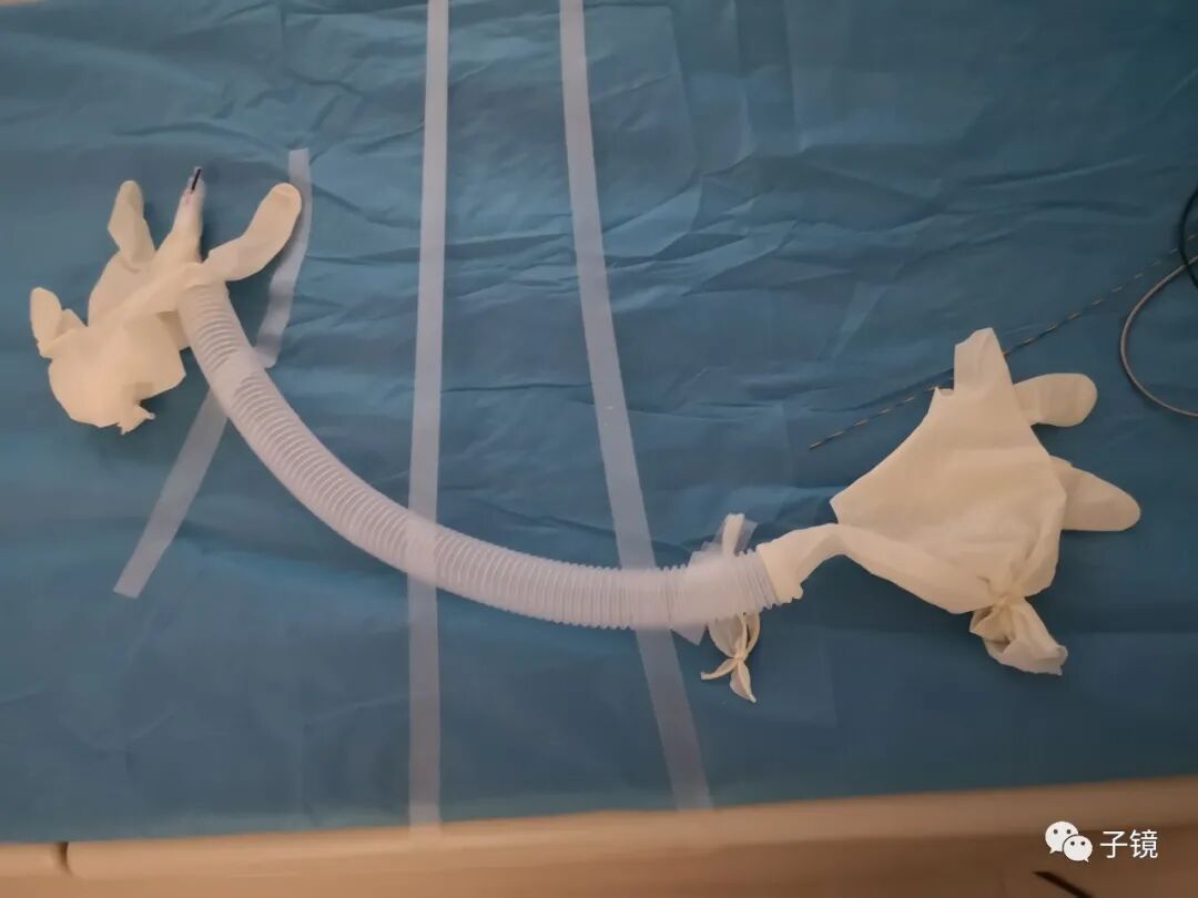 取石球囊怎么取石“ERCP球囊取石细节讨论”学习笔记_https://www.jmylbn.com_新闻资讯_第2张