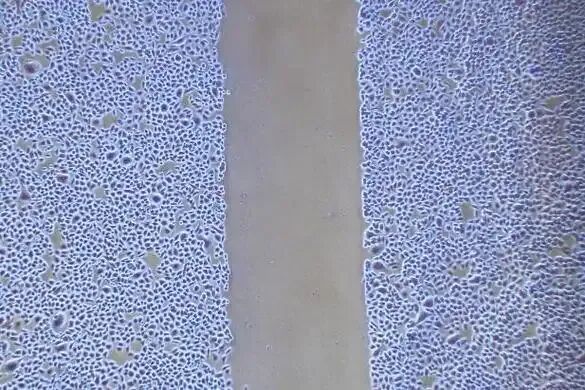 细胞划痕实验制作后观察