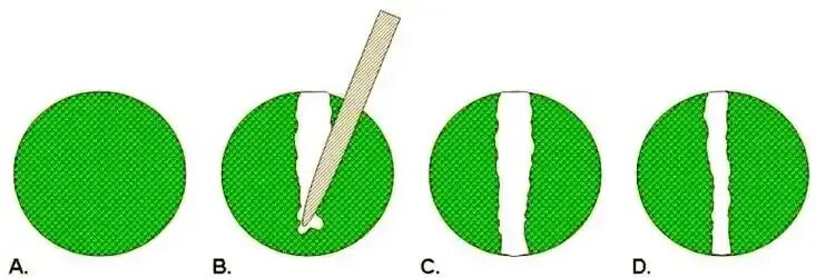 细胞迁移速度的计算