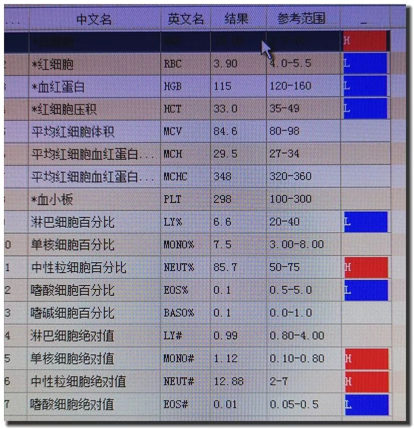 帥男孩爬山回家莫名低燒，一周後從心口抽出一大瓶血紅色液體 健康 第6張