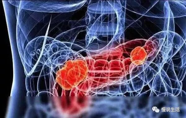 癌症之王“胰腺癌”的元凶终于找到了，这些人最容易患上胰腺癌