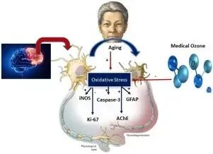 三氧治疗什么三氧疗法是什么？_https://www.jmylbn.com_新闻资讯_第1张