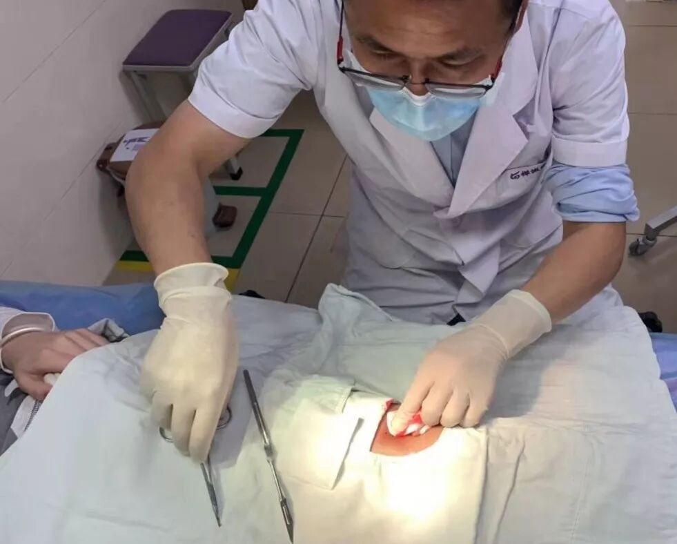 缝合怎么换药换药20多天未愈合的伤口，继续换药or缝合？_https://www.jmylbn.com_新闻资讯_第4张