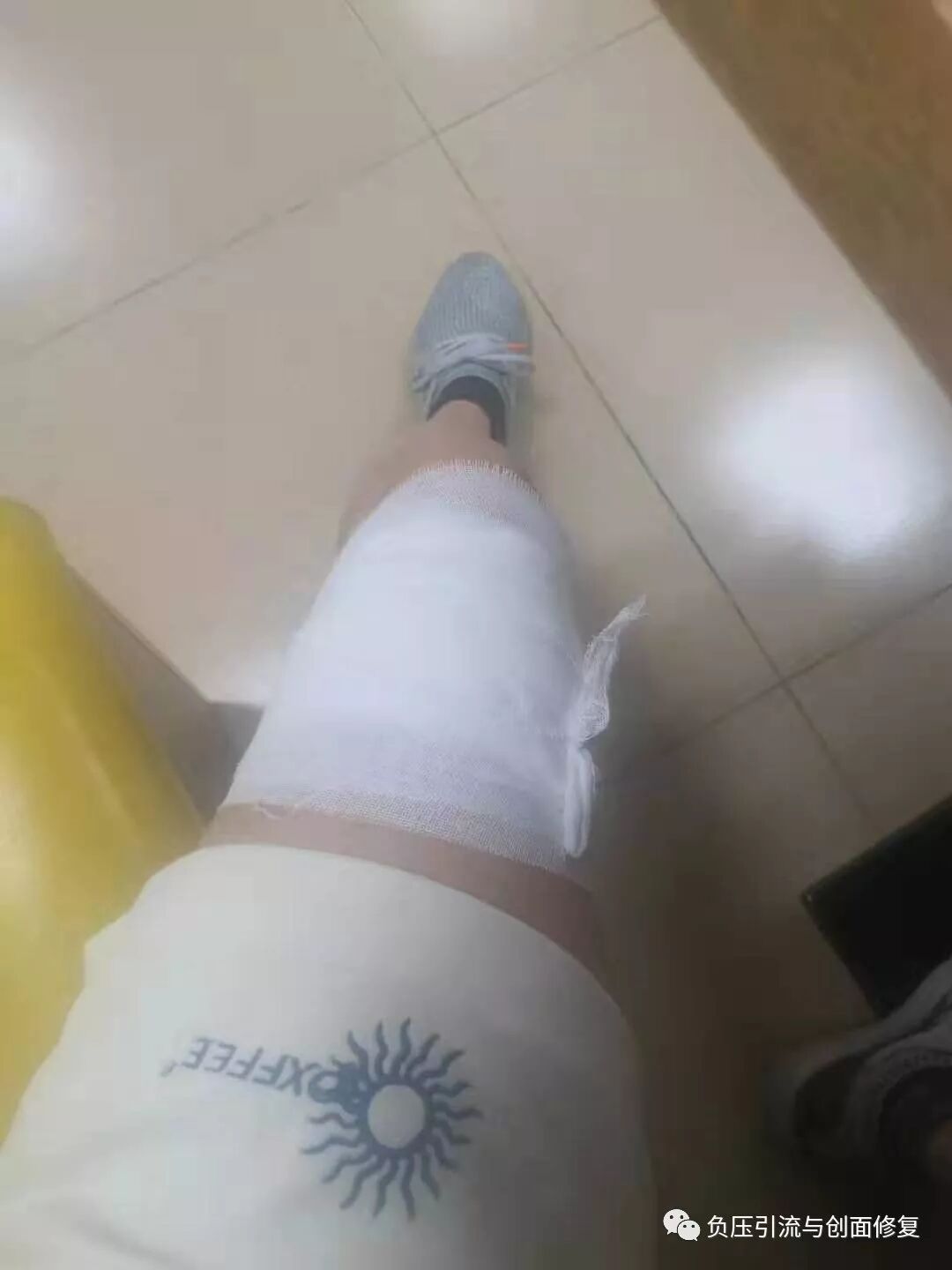 缝合怎么换药换药20多天未愈合的伤口，继续换药or缝合？_https://www.jmylbn.com_新闻资讯_第7张