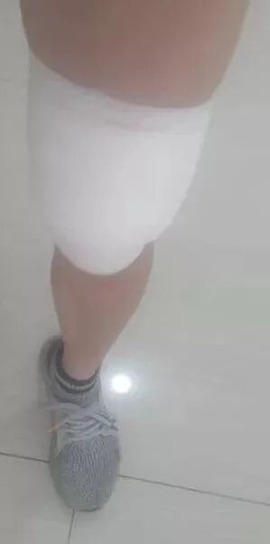 缝合怎么换药换药20多天未愈合的伤口，继续换药or缝合？_https://www.jmylbn.com_新闻资讯_第9张