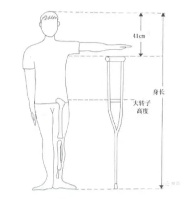 可调膝关节支具怎么用前叉术后“第三条腿”（支具）的使用_https://www.jmylbn.com_新闻资讯_第2张