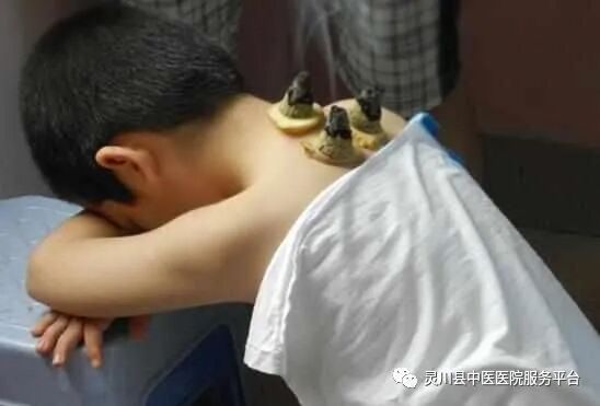 感冒治疗仪怎么用孩子反复感冒咳嗽怎么办？绿色、无毒、安全有效的疗法，您值得了解！_https://www.jmylbn.com_新闻资讯_第11张