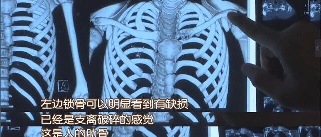 12岁男孩肺癌晚期，妈妈崩溃说出细节：别在“垃圾堆”里养孩子！