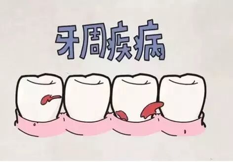 这个口腔疾病，竟会毁掉一整口牙！