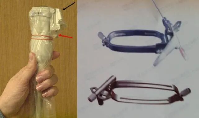 穿刺枪怎么升级肾脏穿刺活检术：入门教程_https://www.jmylbn.com_新闻资讯_第8张