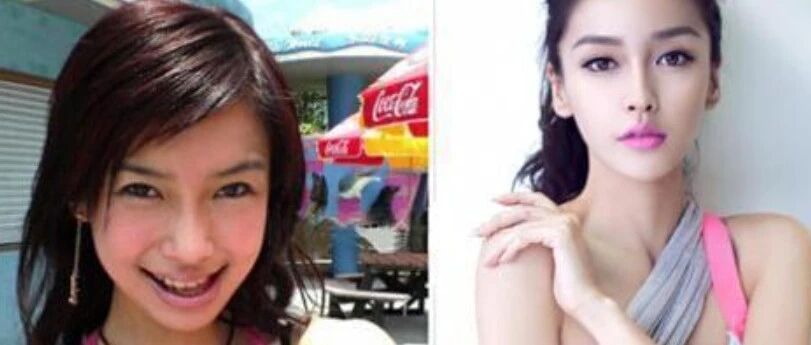 “换头改命”的6位明星，有的主动承认削骨，有的作品全被下架！