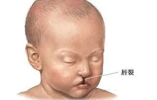 尼古丁会引起血管收缩,影响某些器官的发育,引起胎儿畸形,如腭裂,腹裂