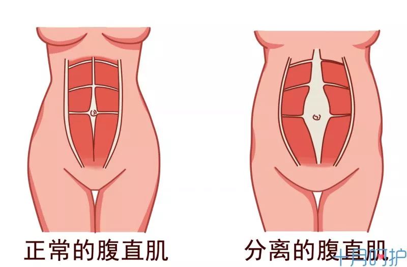 產後半年一定要做這個檢查 否則越減越胖 十月呵護 微文庫