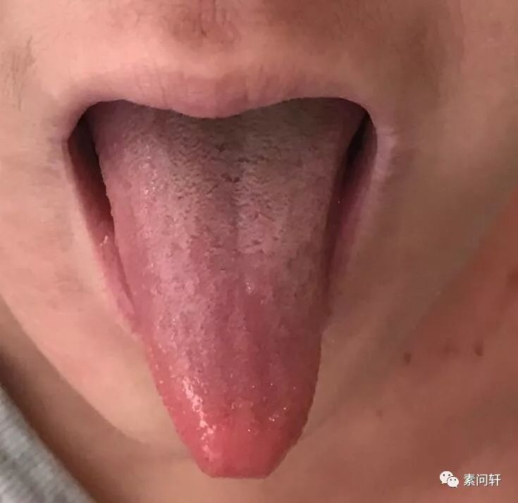 當心！君相二火即將當令，陰虛之人很煎熬容易生病！判斷陰虛體質的九大症狀 健康 第6張