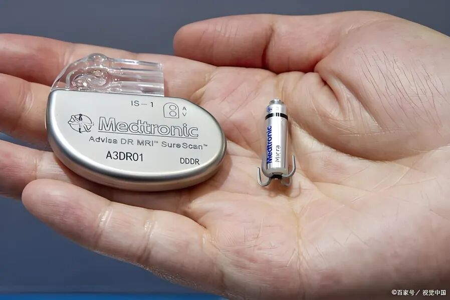 什么是介入耗材盘点介入医学中有哪些植入耗材？_https://www.jmylbn.com_新闻资讯_第6张