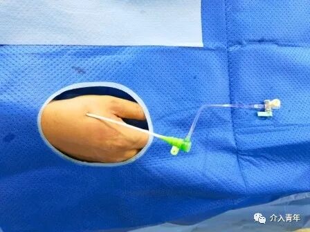 手术帽怎么消毒中山二院事件后思考：需注意介入手术室的院感防控_https://www.jmylbn.com_新闻资讯_第5张