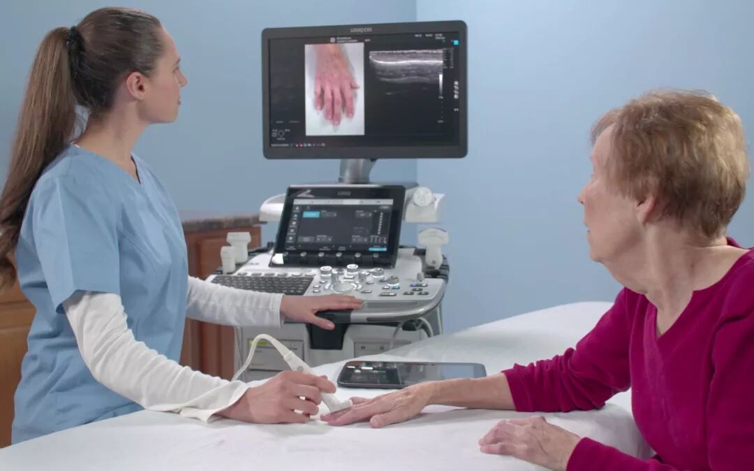 logiq e怎么读双擎聚力 智慧先行- GE医疗旗舰款全身超声LOGIQ™ E20中国上市_https://www.jmylbn.com_新闻资讯_第5张