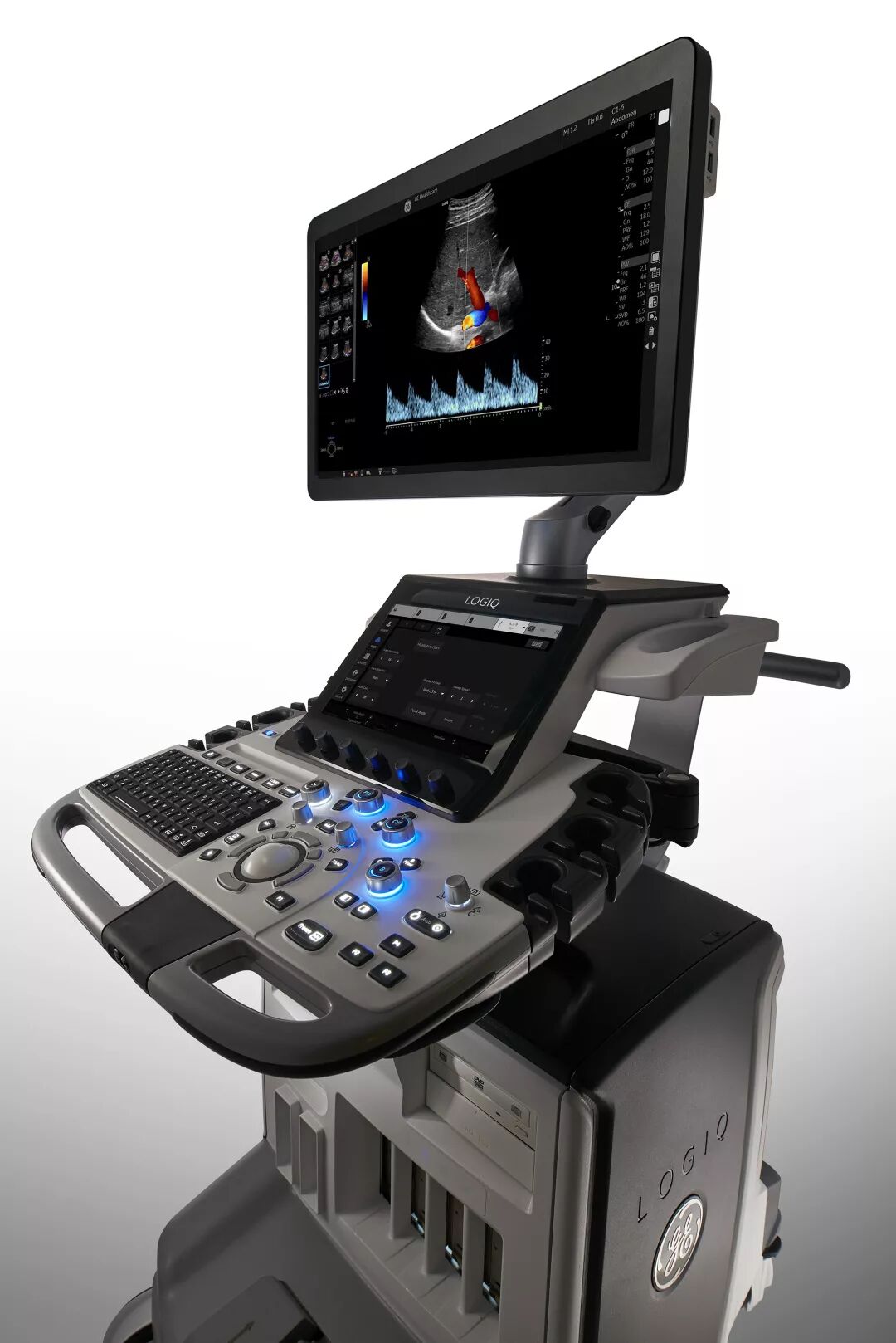 logiq e怎么读双擎聚力 智慧先行- GE医疗旗舰款全身超声LOGIQ™ E20中国上市_https://www.jmylbn.com_新闻资讯_第3张