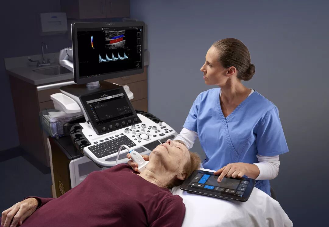 logiq e怎么读双擎聚力 智慧先行- GE医疗旗舰款全身超声LOGIQ™ E20中国上市_https://www.jmylbn.com_新闻资讯_第6张