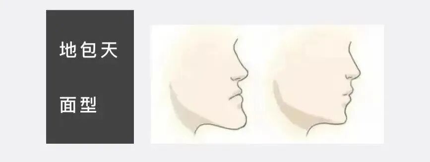 激光和电刀区别是什么为什么要剪舌系带？_https://www.jmylbn.com_新闻资讯_第21张