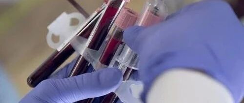 验血都能够查出什么病？