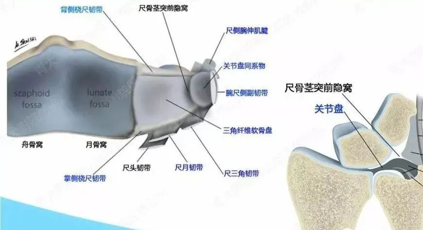 運動人群手腕疼痛小心tfcc損傷