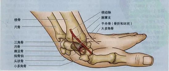 腕舟骨骨折治疗原则及康复指导_骨折 - 好大夫在线