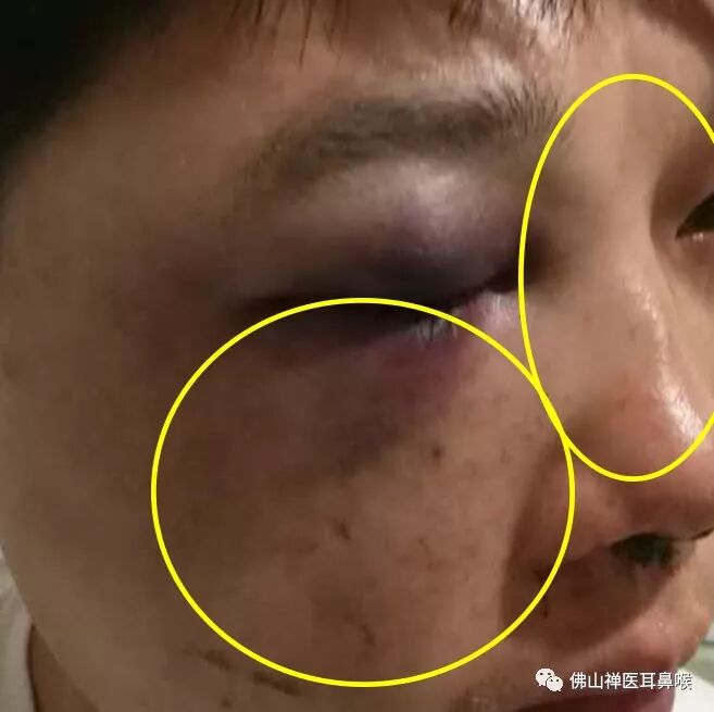 面部外伤毁容,有人帮你重拾美貌 - 好大夫在线