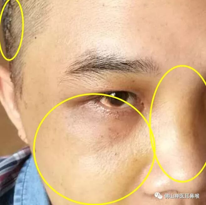 面部外伤毁容,有人帮你重拾美貌 - 好大夫在线