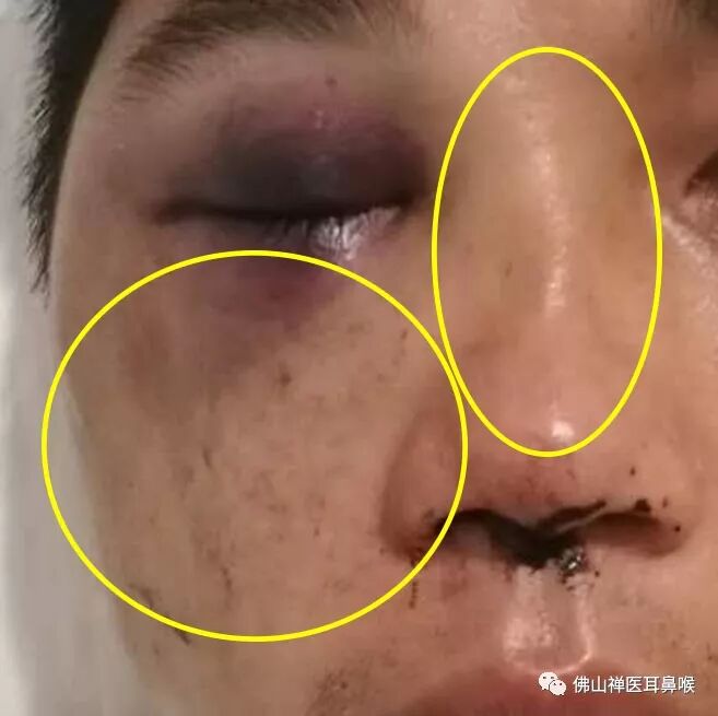 面部外伤毁容,有人帮你重拾美貌 - 好大夫在线