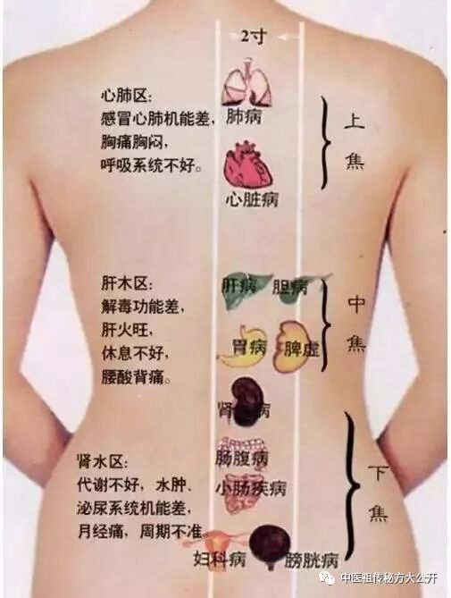 华佗怎么刮痧背部常刮痧，活到九十八！（专业医师示范）_https://www.jmylbn.com_新闻资讯_第2张