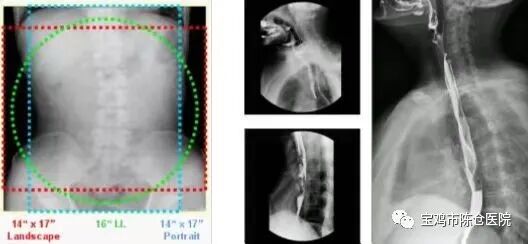 什么是数字胃肠机『新技术新设备』动态平板多功能数字化胃肠机  开启区域影像诊疗新篇章！_https://www.jmylbn.com_新闻资讯_第10张