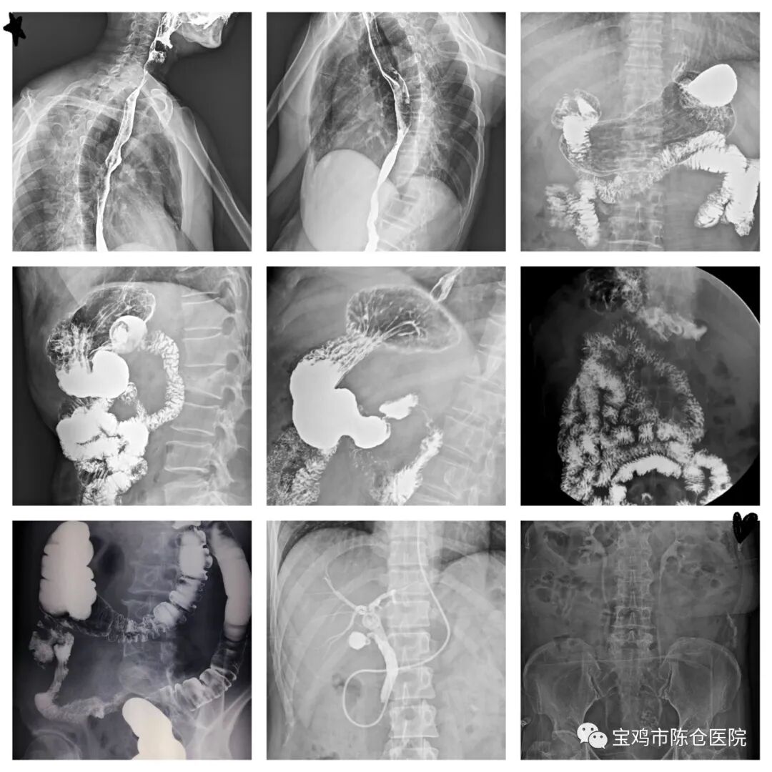 什么是数字胃肠机『新技术新设备』动态平板多功能数字化胃肠机  开启区域影像诊疗新篇章！_https://www.jmylbn.com_新闻资讯_第13张