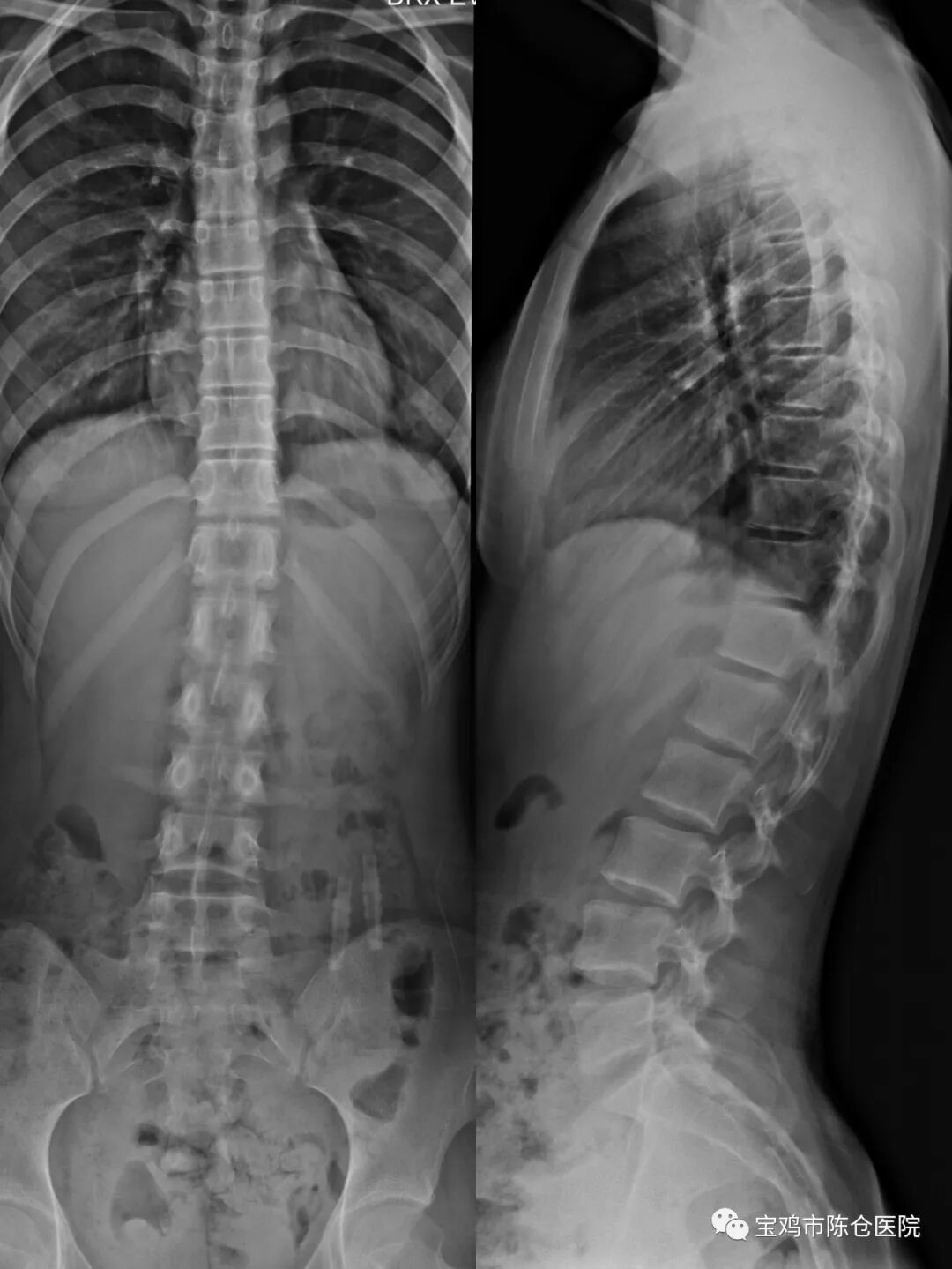 什么是数字胃肠机『新技术新设备』动态平板多功能数字化胃肠机  开启区域影像诊疗新篇章！_https://www.jmylbn.com_新闻资讯_第14张