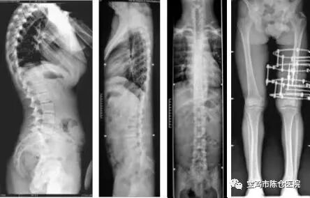 什么是数字胃肠机『新技术新设备』动态平板多功能数字化胃肠机  开启区域影像诊疗新篇章！_https://www.jmylbn.com_新闻资讯_第12张