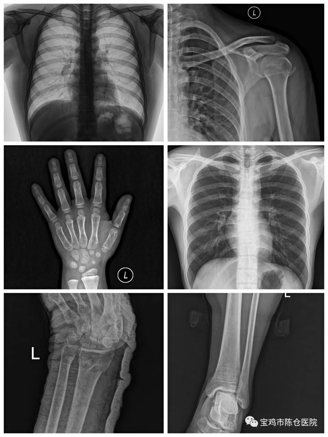 什么是数字胃肠机『新技术新设备』动态平板多功能数字化胃肠机  开启区域影像诊疗新篇章！_https://www.jmylbn.com_新闻资讯_第15张