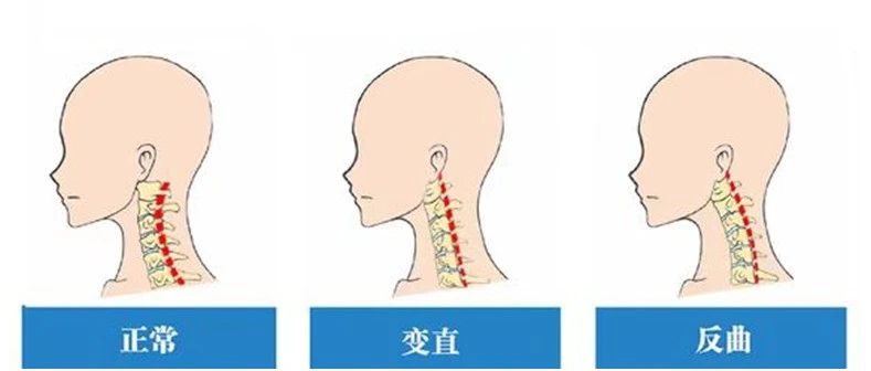 cover_image