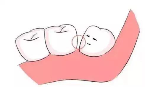 一口好牙對孩子有多重要？這個護牙方法就要從小做到！ 親子 第8張
