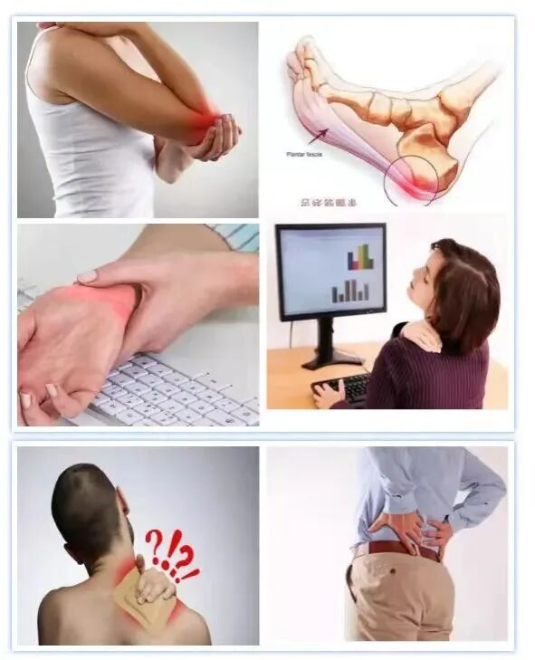 疼痛科怎么理疗三院疼痛科的理疗（一）——神秘的冲击波疗法_https://www.jmylbn.com_新闻资讯_第8张