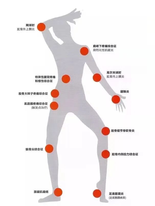 疼痛科怎么理疗三院疼痛科的理疗（一）——神秘的冲击波疗法_https://www.jmylbn.com_新闻资讯_第7张