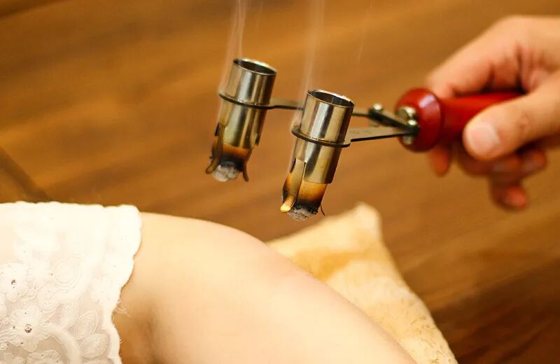 电子艾灸仪原理是什么居家养生丨宅家艾灸，如何选择适宜艾灸器具？_https://www.jmylbn.com_新闻资讯_第3张